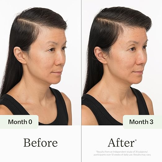 SkinAura Follicle Boost Serum